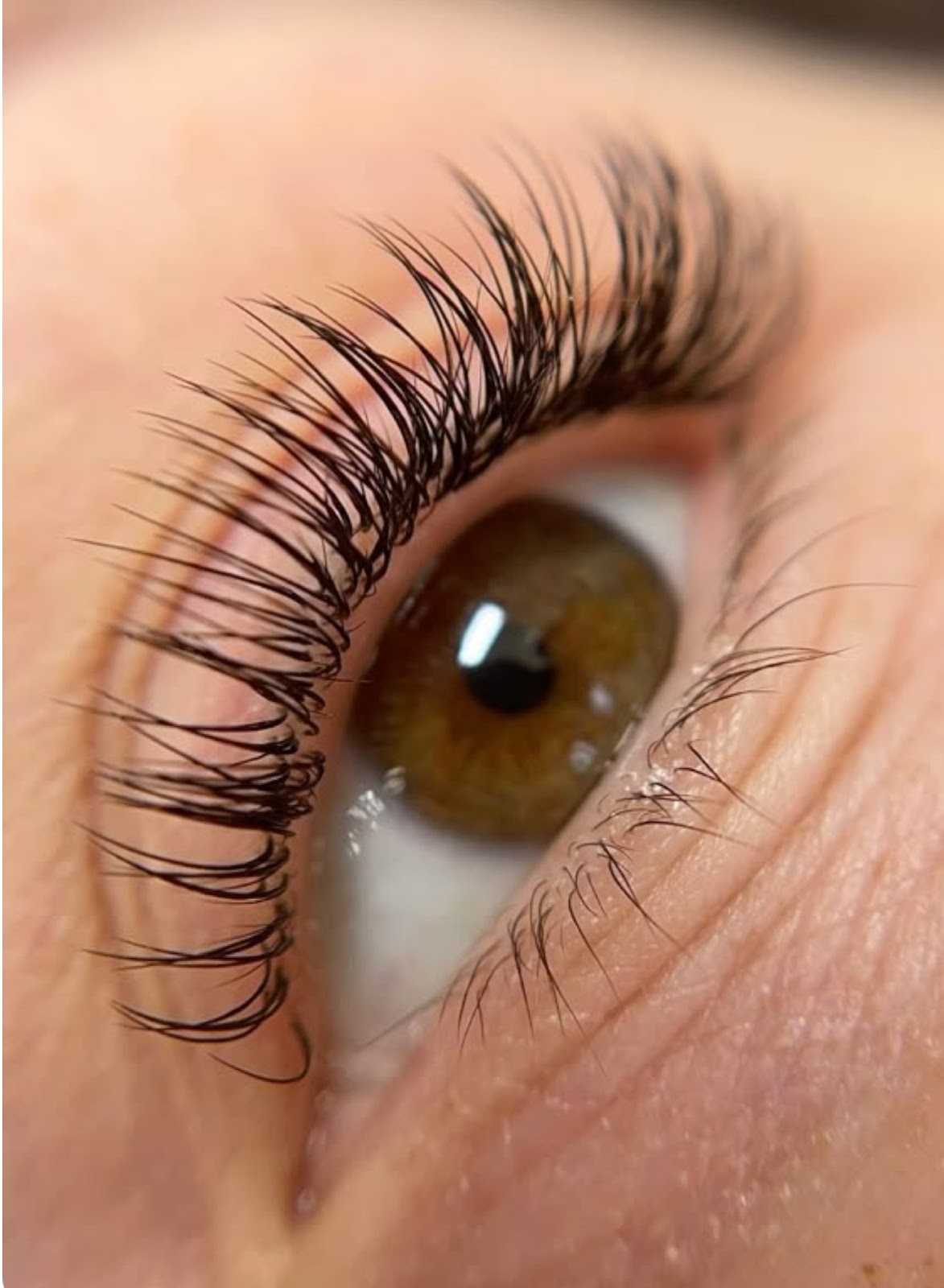 Trattamento zona occhi