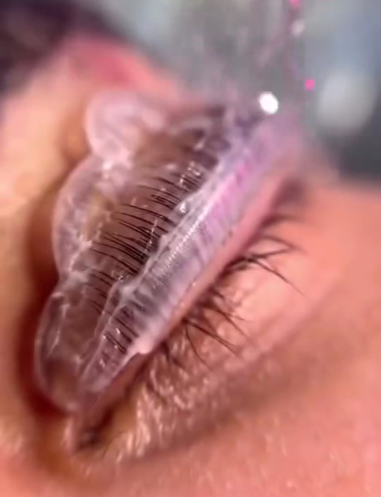 Trattamento occhi in corso